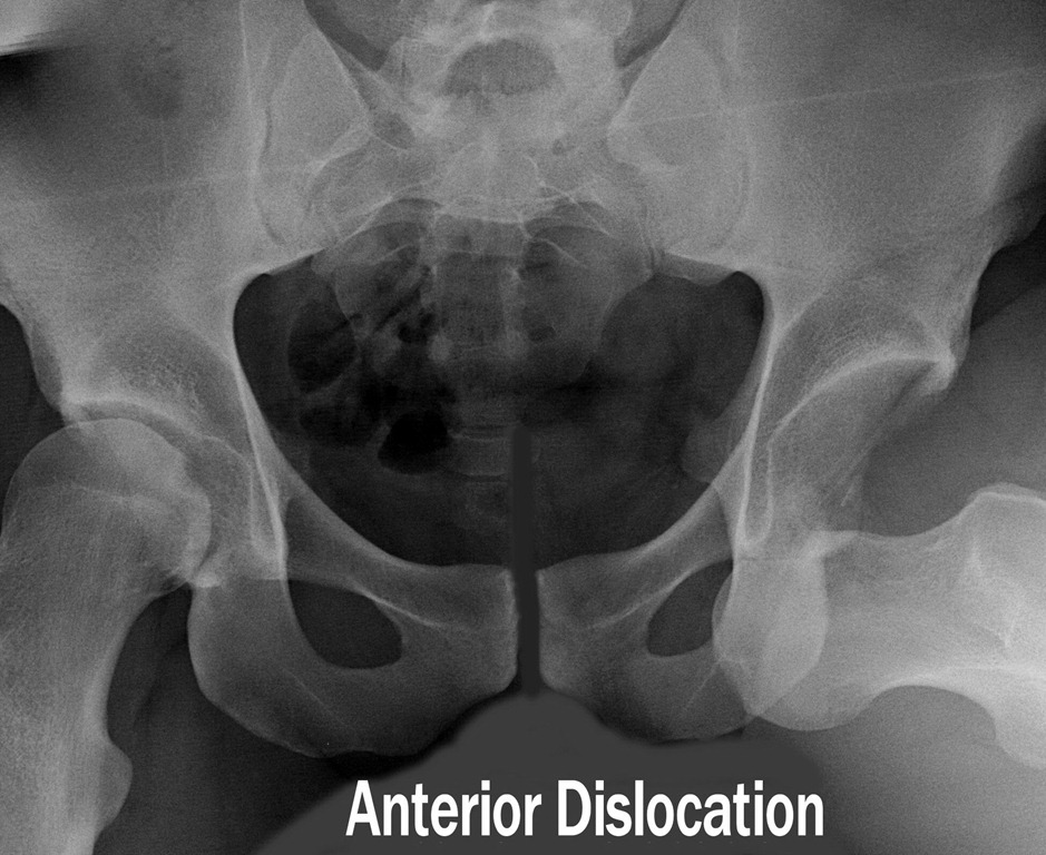 [anterior22.jpg]