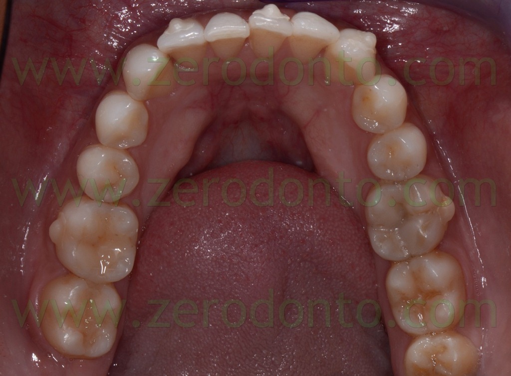 [Fig.%2520143%2520occlusale%2520inferiore%255B3%255D.jpg]