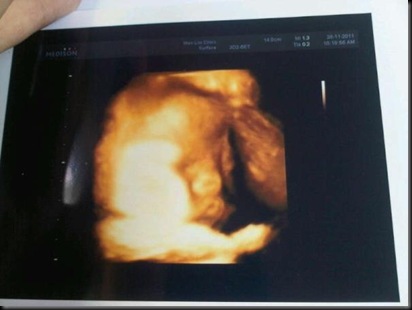 baby 3D scan2