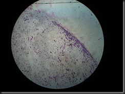 lipoma high resolution histology slide tsnaps lipoma high resolution histology slide tsnaps