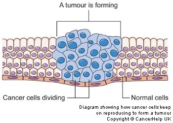 cancer cells cancer cells