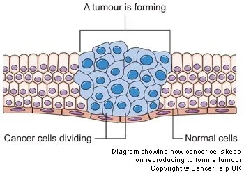 cancer cells