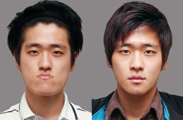 [korean-plastic-surgery-42%255B2%255D.jpg]