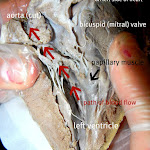 heart_papillary_muscle_labeled.JPG