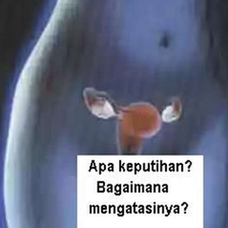 Apa Itu Keputihan Pada Wanita dan Penyebabnya Apa Itu Keputihan Pada Wanita dan Penyebabnya