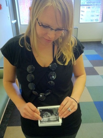 [Ultrasound%25202%252013%25202012%255B3%255D.jpg]