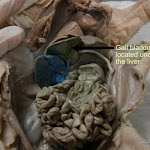 fetal_pig_gall_bladder02.JPG
