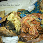 pancreatic_L.JPG
