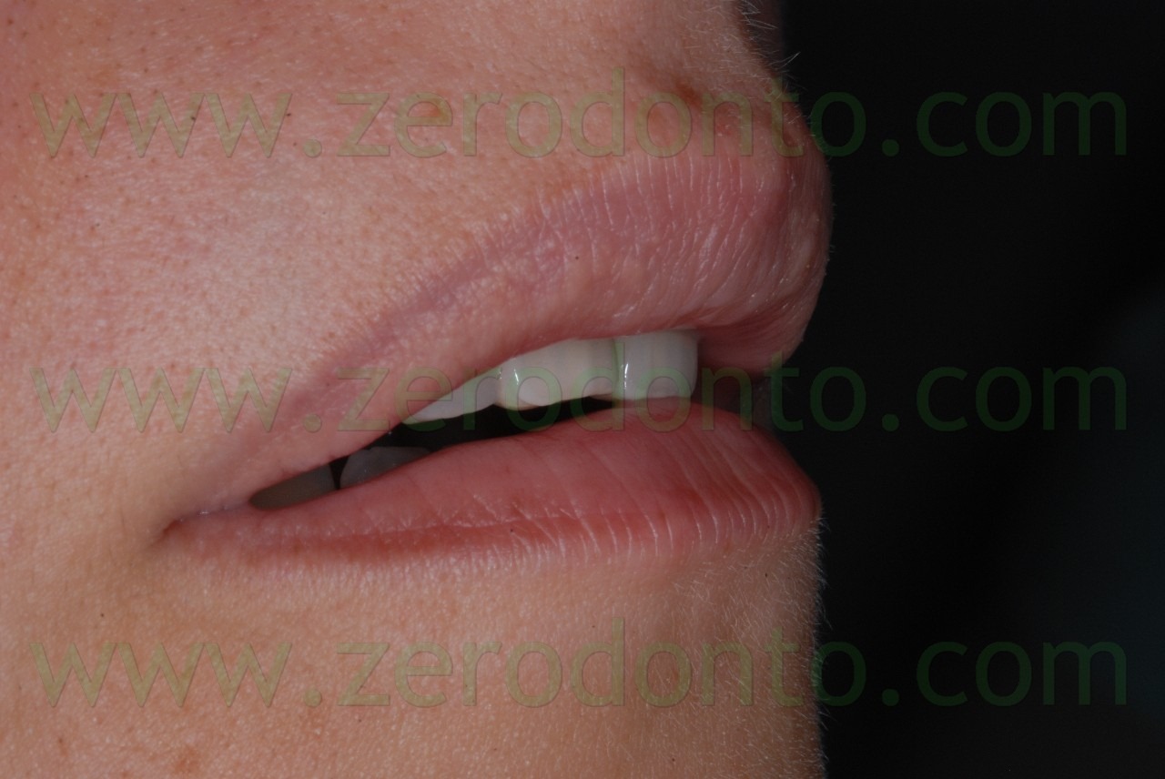 [DSC_49572.jpg]