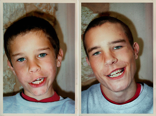 NICO in 1990 & 2010, France NICO in 1990 & 2010, France