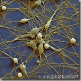 Neural_progenitor_cells Neural_progenitor_cells