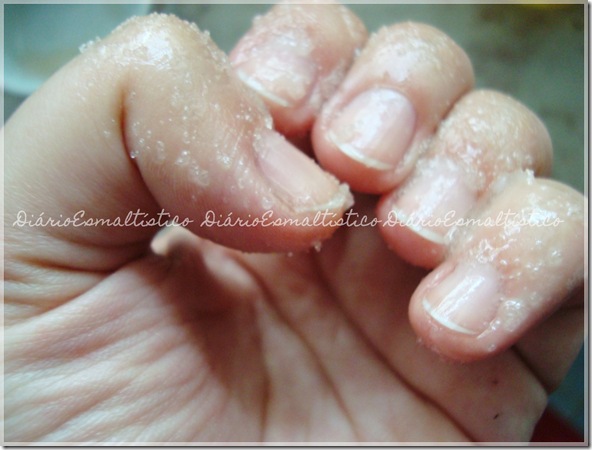 esfoliaçao3 esfoliaçao3