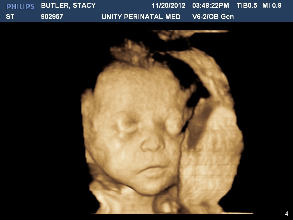 [BUTLERSTACY20121120154823219%255B3%255D.jpg]