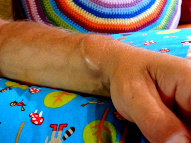 [Organspende%255B3%255D.jpg]