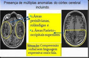 GENETICO GENETICO