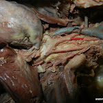 arch_of_aorta.JPG