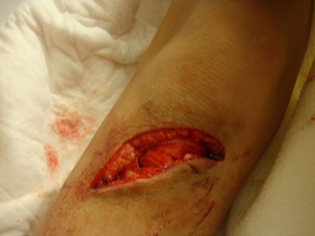 [laceration%255B4%255D.jpg]