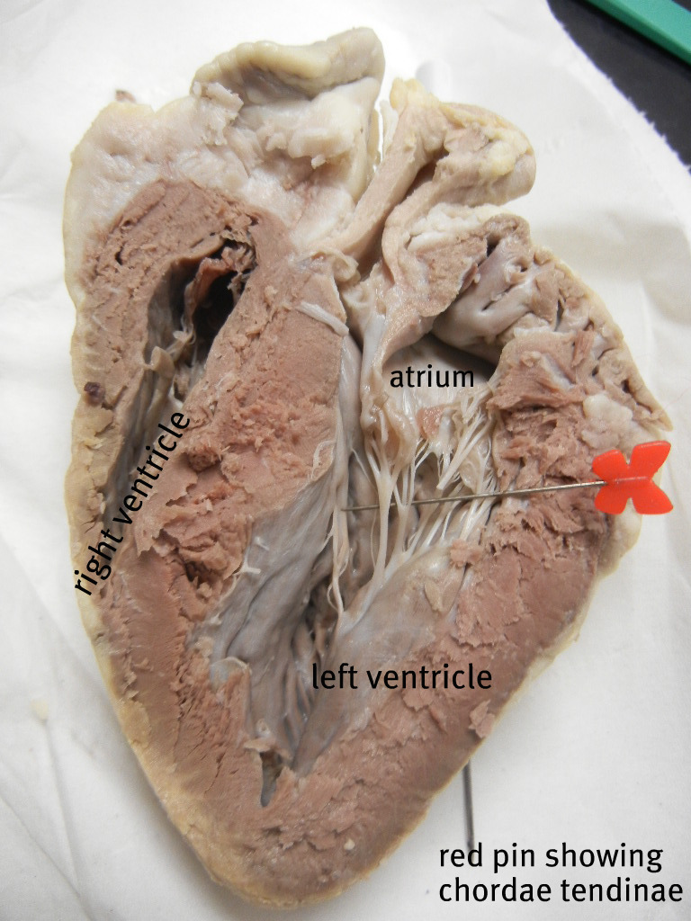 The pin is just under the chordae tendinae, which are tiny tendons that