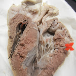 heart_ventricle_pin_labeled.JPG