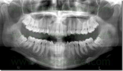 FIG. 9 b