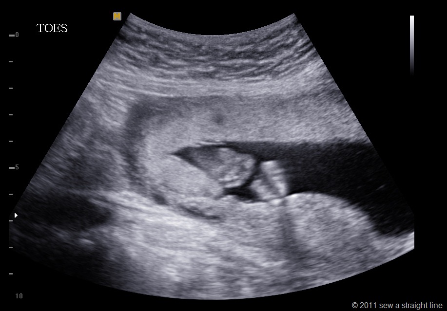 [BABY%2520GUBLER_0008%255B11%255D.jpg]