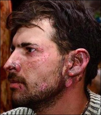 PEACH DAWIE thumb RISKASRUS RANDFONTEIN TORCHED Feb132012