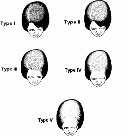 hairfall1 hairfall1