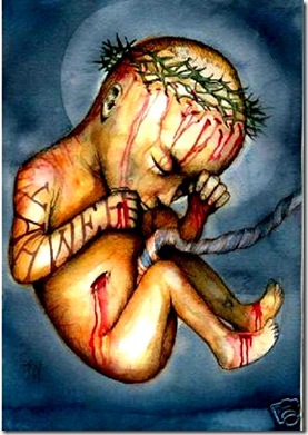jesus-crucified-in-the-womb jesus-crucified-in-the-womb