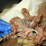 mesentery.JPG