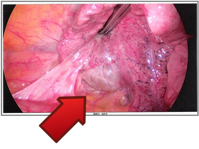 [lung%2520infection%255B4%255D.jpg]