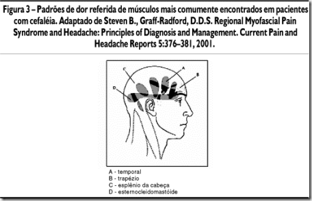 sindrome dolorosa miofascial acupuntura curitiba 3