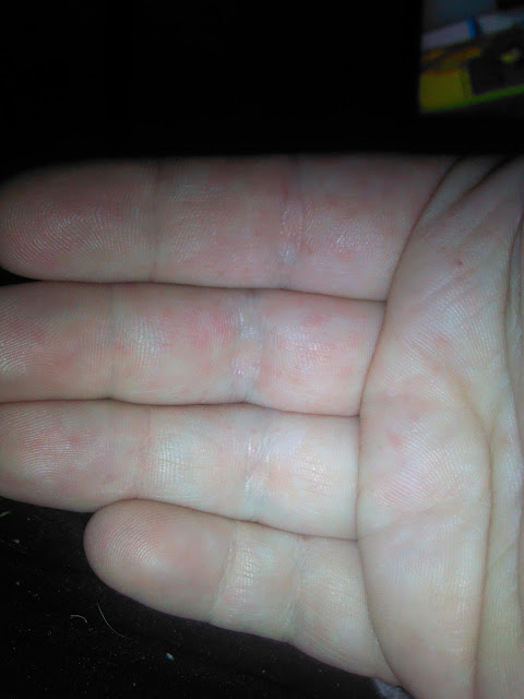 mild latex allergy model mayhem mature