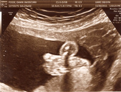 child #4 ultrasound 4