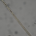 Diatom