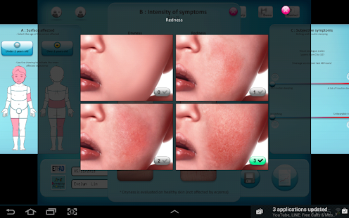 How to download PO-Scorad patch 3.0 apk for android
