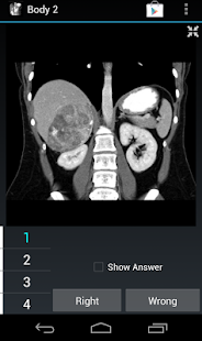 How to mod Radiology Flashcards: Body 3 1.4 apk for pc