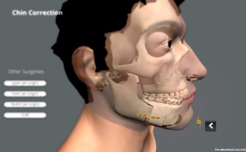 How to install Sur 'FACE' 1.0.0 apk for laptop