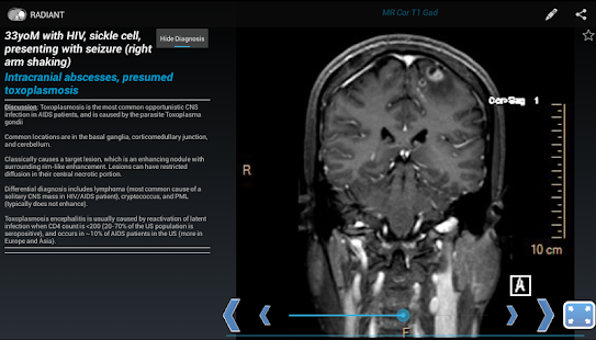 How to mod RADIANT: Share Radiology Cases patch 1.2 apk for pc