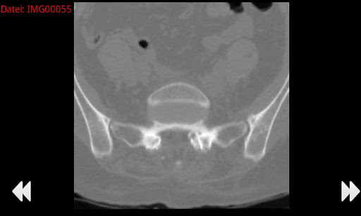 【免費醫療App】Minimal Dicom Viewer-APP點子