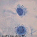 Aspergillus flavus