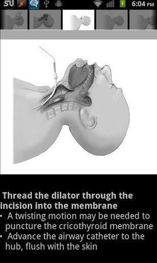 EM Procedures Free