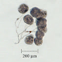 Colonial Protozoan - Carchesium