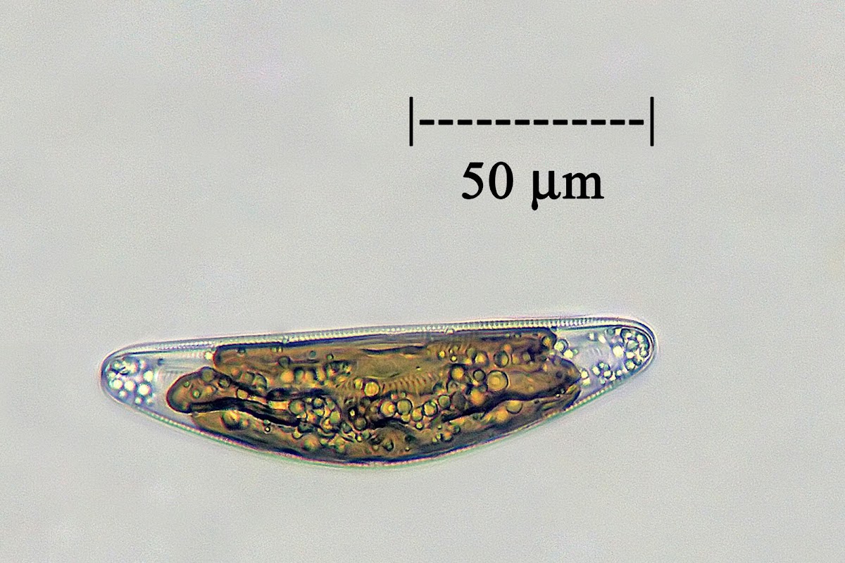Diatom