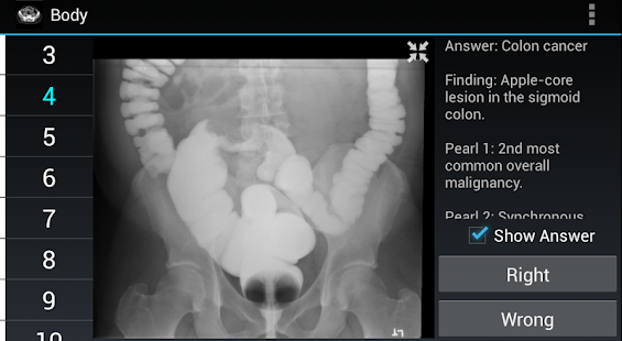 How to install Radiology Flashcards: Body patch 1.4 apk for pc
