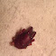 Woodlouse hunting spider