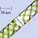 Spirogyra