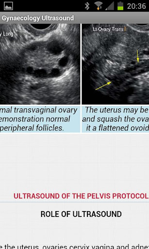 【免費醫療App】Gynecology Ultrasound-APP點子