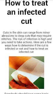 How to download How to treat. Medicine at home 1.0 mod apk for bluestacks