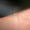 Aphid