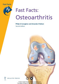 Fast Facts: Osteoarthritis